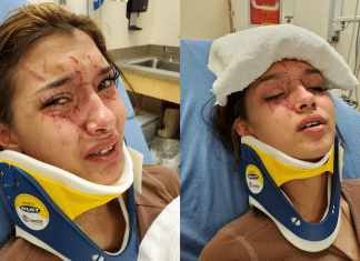 A Teenager in Clifton, TX Was Lured to a Park by Her Best Friend Where She Was Attacked and Beaten Up clifton teenager attacked in park