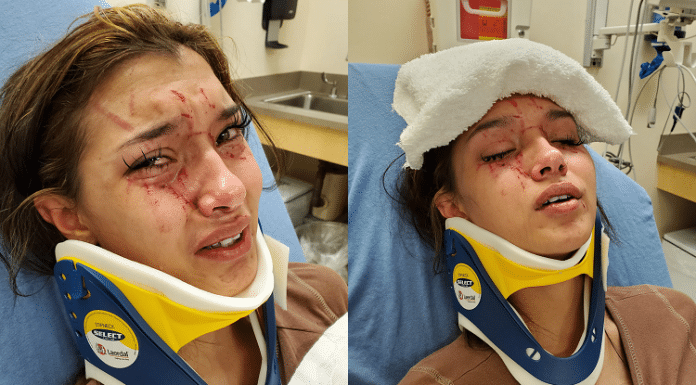 A Teenager in Clifton, TX Was Lured to a Park by Her Best Friend Where She Was Attacked and Beaten Up clifton teenager attacked in park